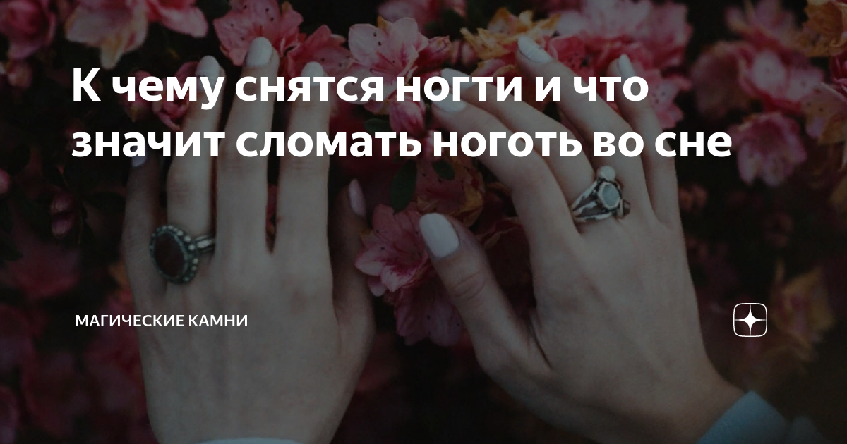 «Что означает подстригать ногти во сне?» — Яндекс Кью