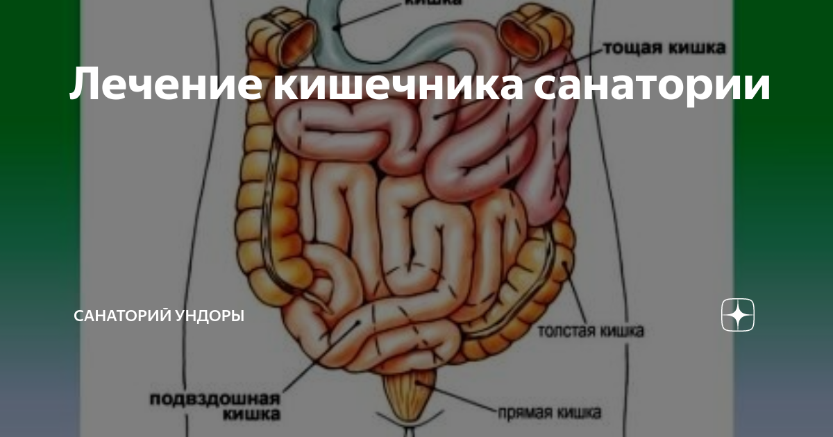 Как лечить кишки. Санатории лечащие желудочно кишечный тракт лучшие.