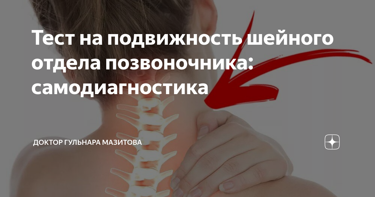 Подвижность позвонков шейного отдела. Подвижность шейного отдела. Тесты на подвижность позвоночника. Шейный хондроз.