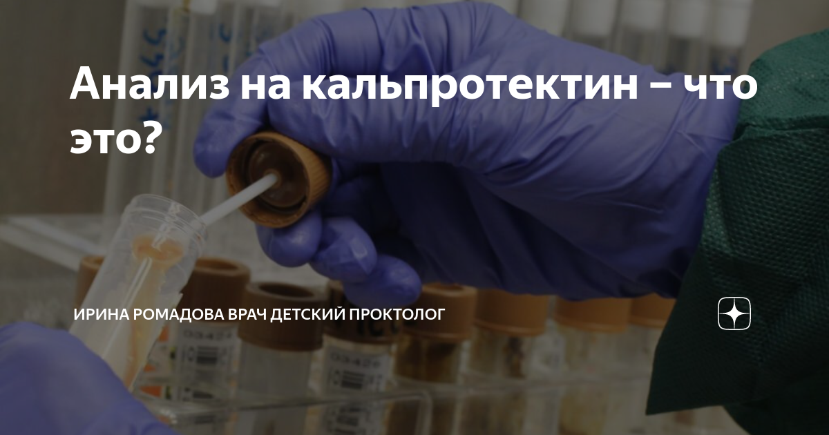 сколько по времени делается анализ кала на кальпротектин