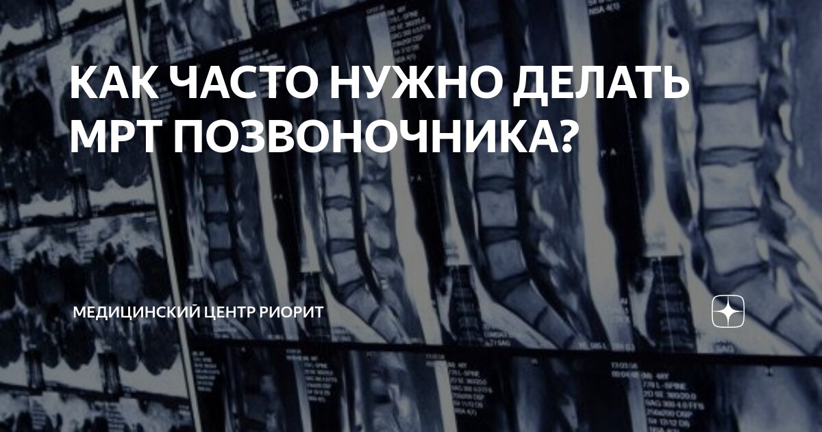 Записаться на мрт позвоночника. Блокирование позвоночника это. Мрт позвоночника на Уралмаше на Космонавтов. Отделы позвоночника для мрт.