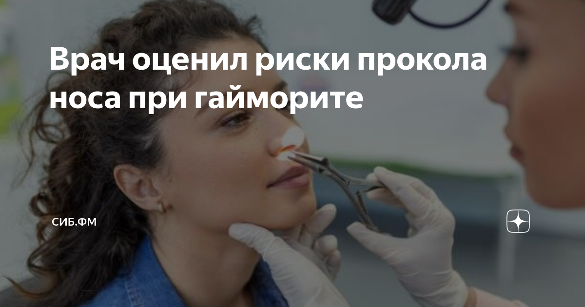 Прокол верхнечелюстной пазухи носа. Пункция верхнечелюстной пазухи при синусите. Прокол носа при гайморите отзывы. Прокол носа при гайморите отзывы. Прокол гайморитной пазцхи.