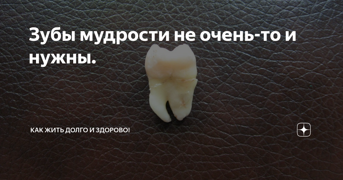 Мудрые зубы отзывы. Мудрые зубы отзывы. Мудрые зубы отзывы. Мем про зуб мудрости суету навести. Мудрые зубы отзывы.
