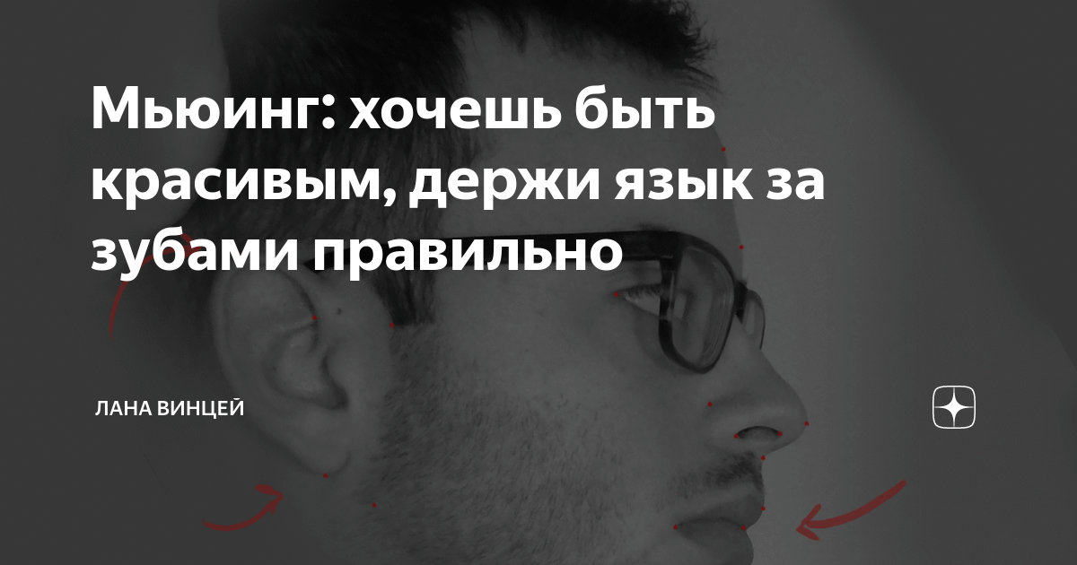 Правильное положение языка во рту мьюинг картинки