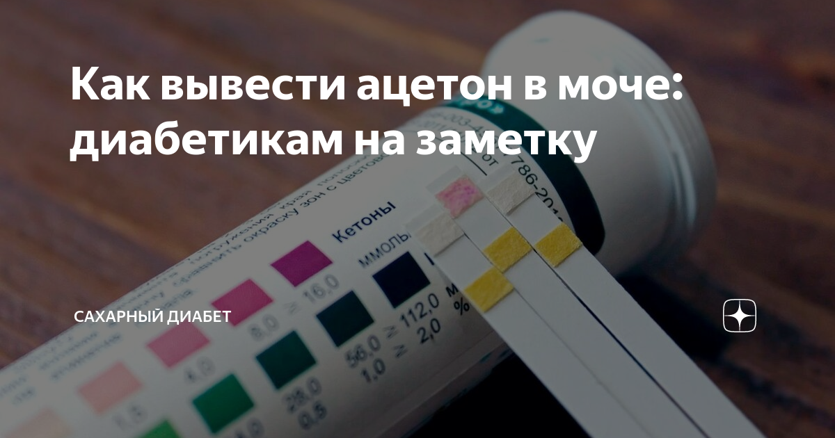 Как вывести мочу. Ацетон в моче при диабете. Ацетон в моче сахарный диабет. Ацетон в моче норма. Ацетон в моче при сахарном диабете 1 типа.