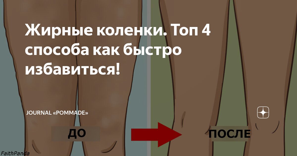 Жирные коленки. Топ 4 способа как быстро избавиться!