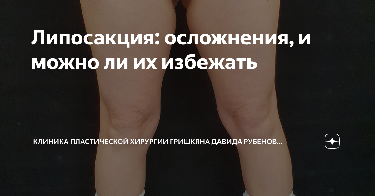 осложнения после липосакции форум