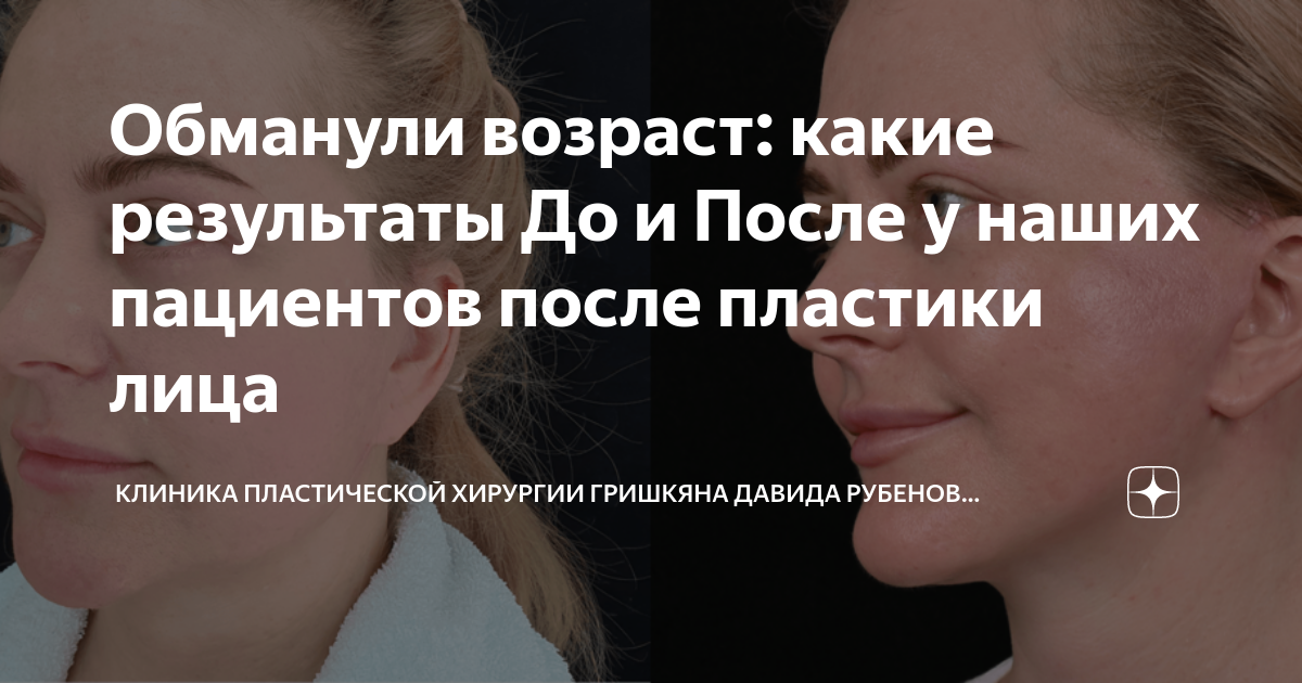 Обманывая возраст