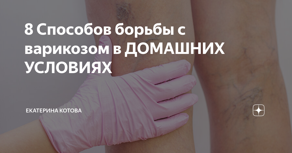 8 Способов борьбы с варикозом в ДОМАШНИХ УСЛОВИЯХ | Здоровые советы | Дзен