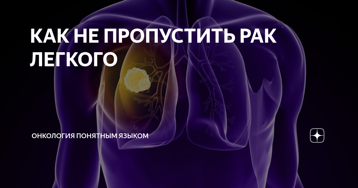 КАК НЕ ПРОПУСТИТЬ РАК ЛЕГКОГО | Онкология понятным языком. Доктор ...