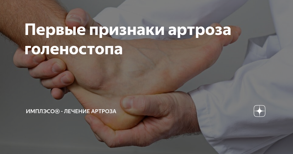 Первые признаки артроза голеностопа | ИМПЛЭСО® - лечение артроза | Дзен