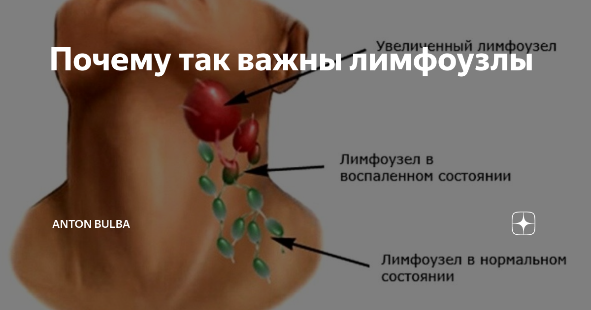 Причины болей лимфоузлов. Лимфатические узлы на шее.