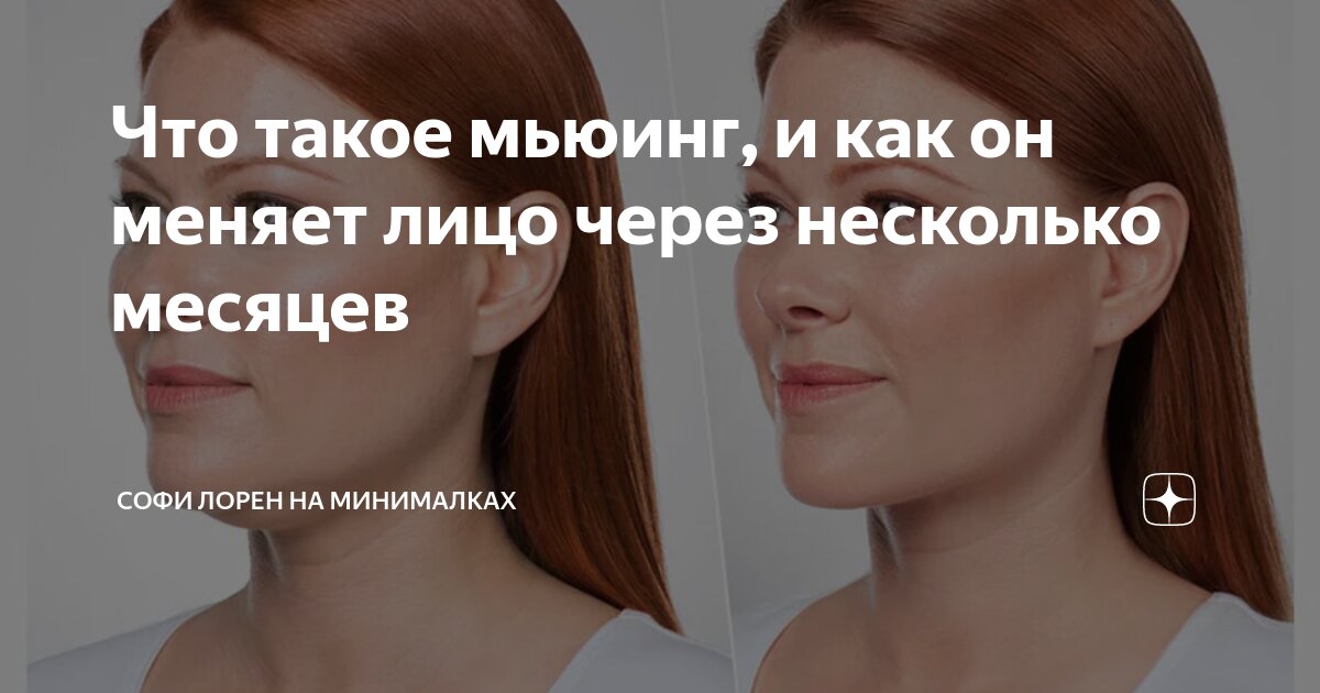 Правильное положение языка во рту мьюинг картинки