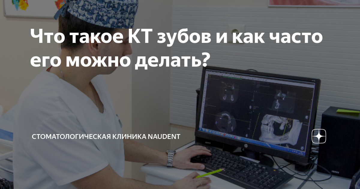 Что такое КТ зубов и как часто его можно делать? | Стоматологическая ...