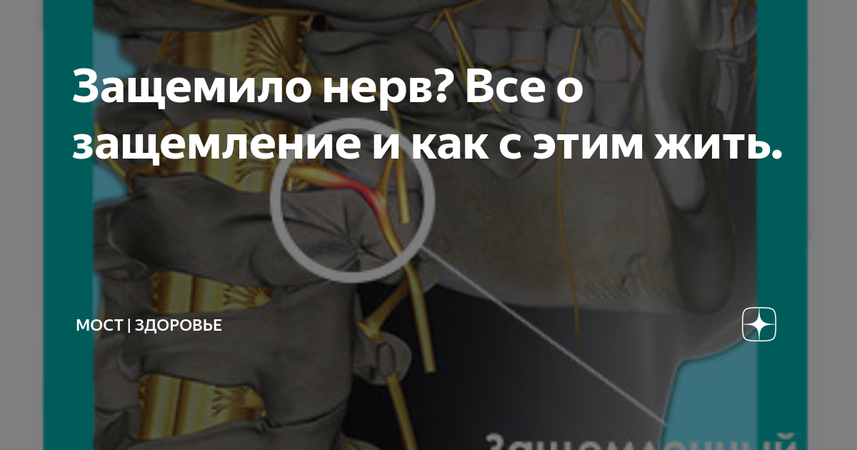 Защемило спину между лопатками — почему это происходит и что делать? | Клиника Temed