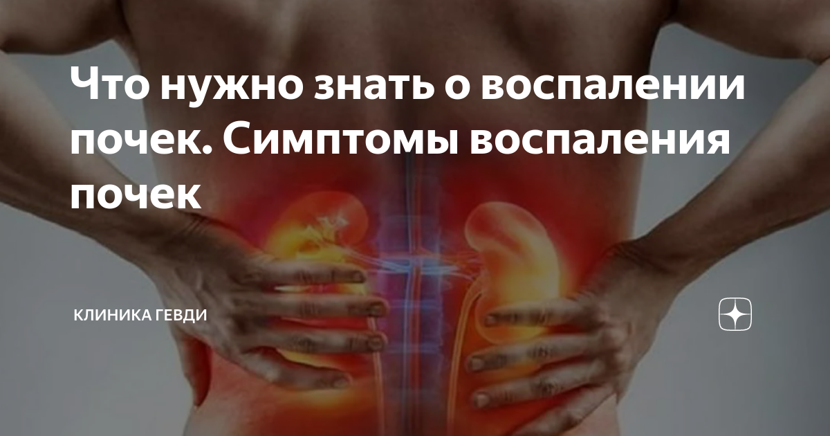 Что нужно знать о воспалении почек. Симптомы воспаления почек | Клиника ...