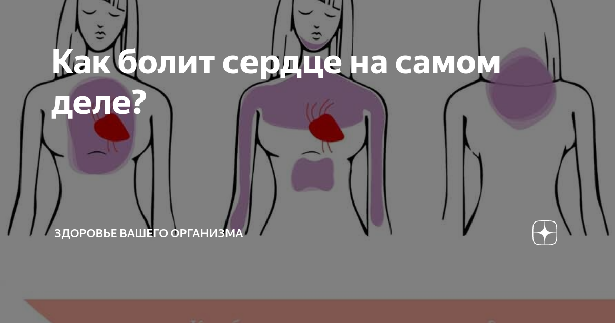 Причина ноющей боли в правой руке - найдено 77 картинок