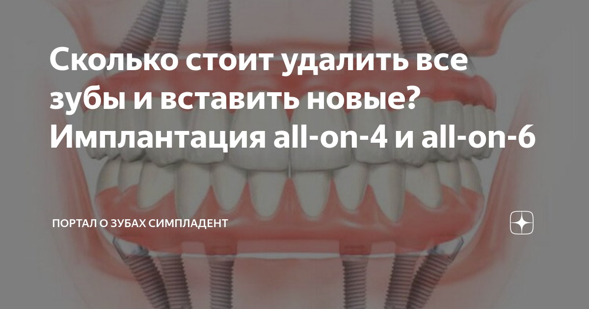 Стоимость протезирования зубов или сколько стоит коронка на зуб?