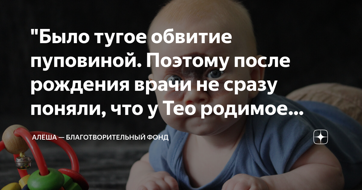 "Было тугое обвитие пуповиной. Поэтому после рождения врачи не сразу ...