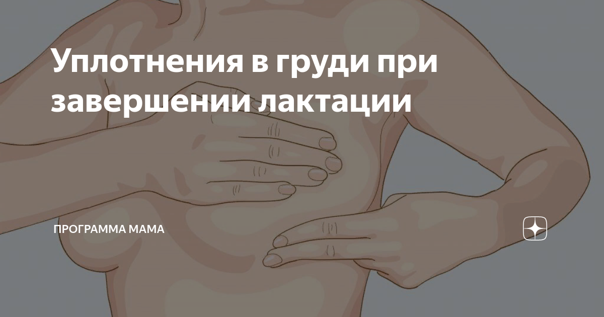 уплотнение в молочной железе при грудном вскармливании