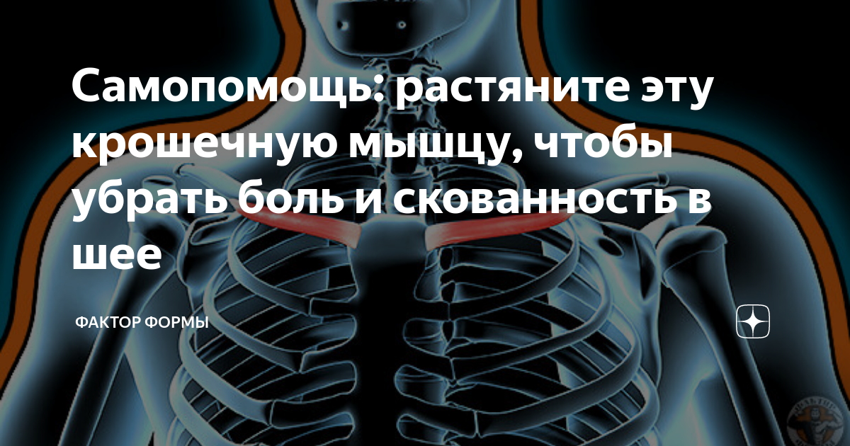 Зажимы в шее. Убрать зажимы в шее. Как убрать зажимы в шее и плечах. Мышцы спины и шеи как убрать зажим. Самопомощь.