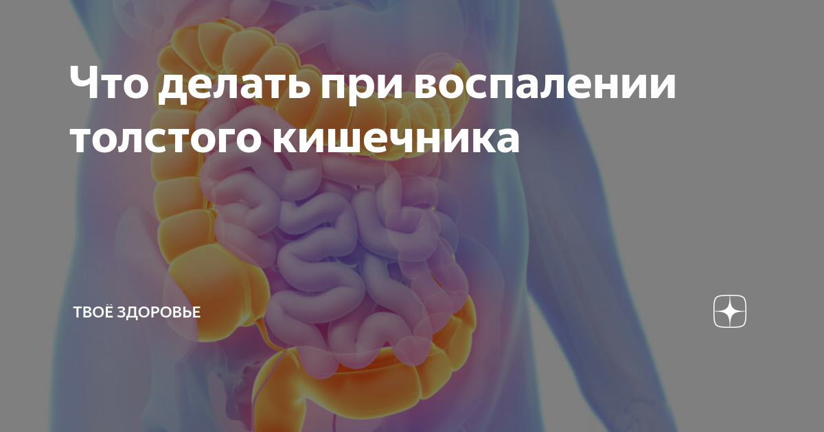 Воспалительные заболевания кишечника у детей. Воспаление Толстого кишечника симптомы у женщин и лечение лекарство.