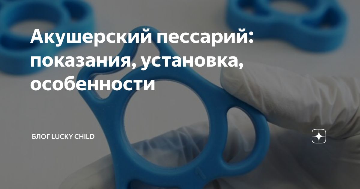 Что такое пессарий при беременности. Акушерский пессарий Тип 2. Введение пессария.