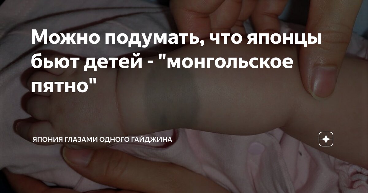 Можно подумать, что японцы бьют детей - "монгольское пятно" | Япония ...