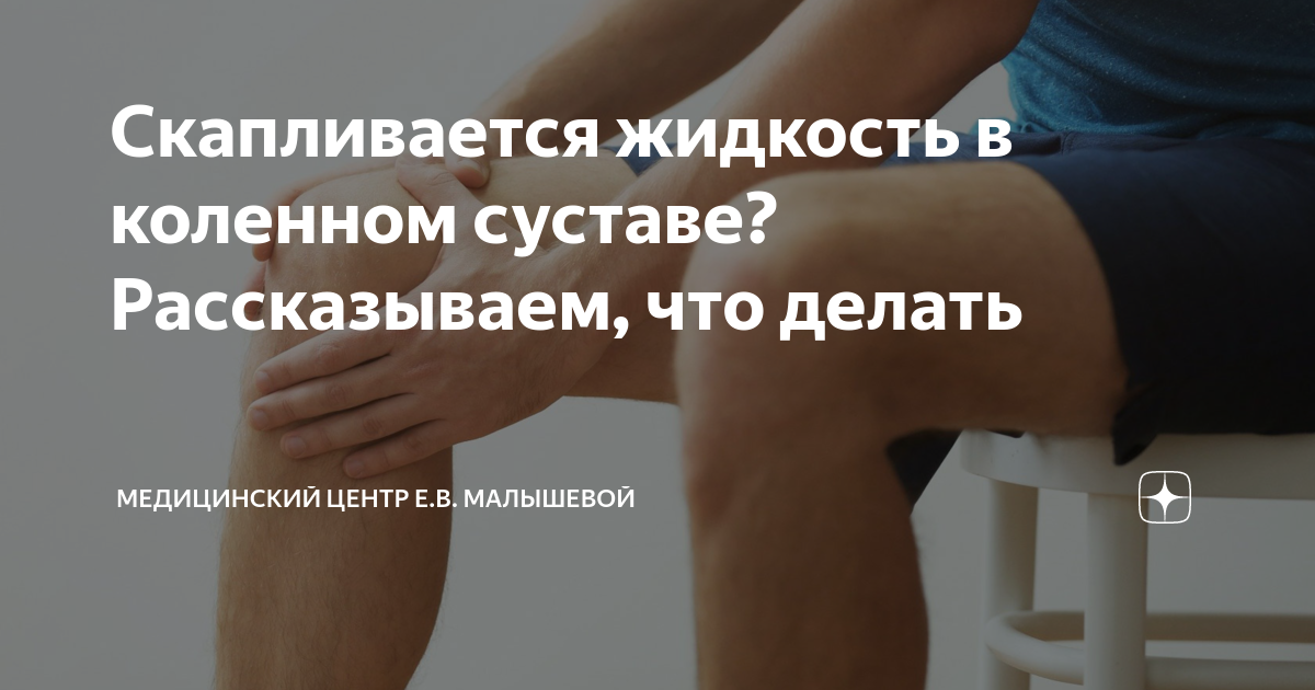 «Как убрать жидкость из коленного сустава в домашних условиях?» — Яндекс Кью