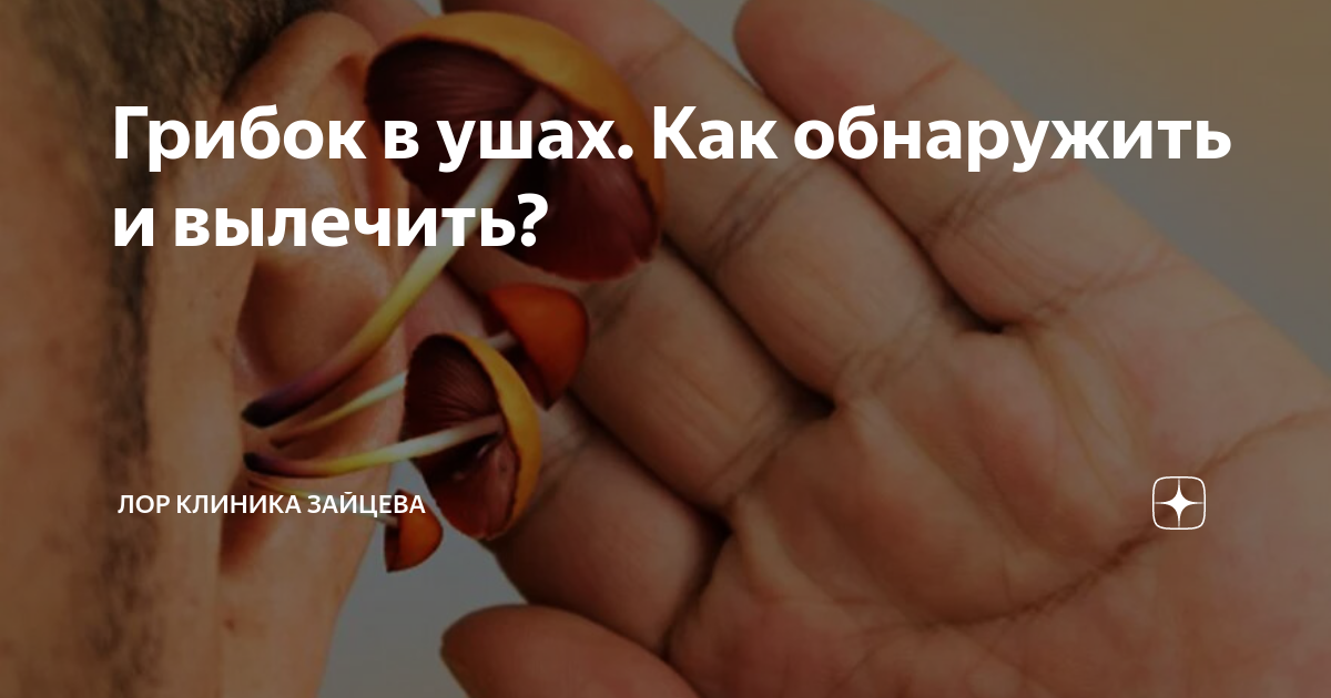 Грибок в ушах. Как обнаружить и вылечить? | ЛОР КЛИНИКА ЗАЙЦЕВА | Дзен