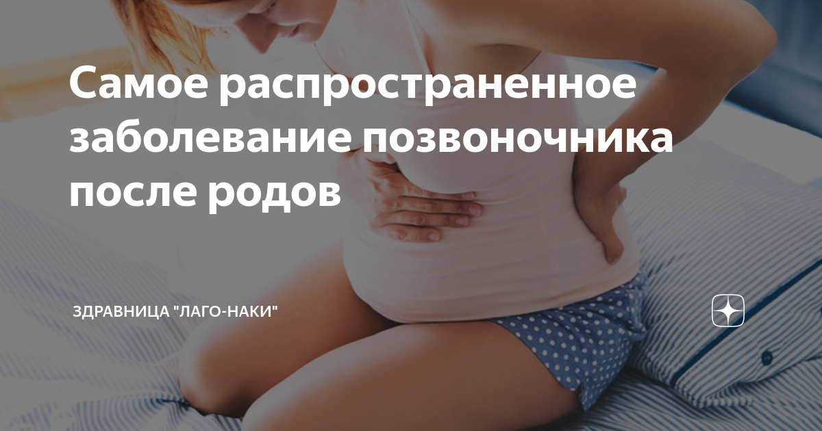 Позвоночник после беременности. Изменение осанки при беременности. Изменение позвоночника в беременность. Аномалии скелета (нарушение осанки матери). Болит спина после родов.