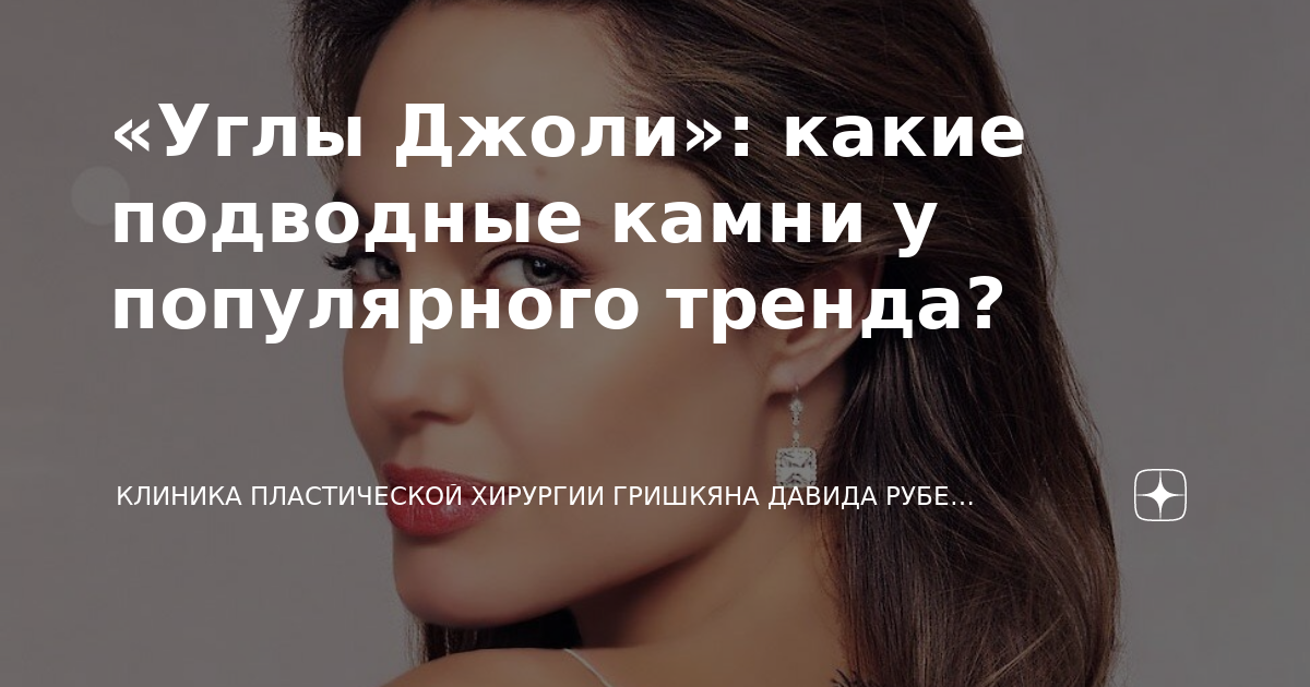 «Углы Джоли»: какие подводные камни у популярного тренда? | Современный ...
