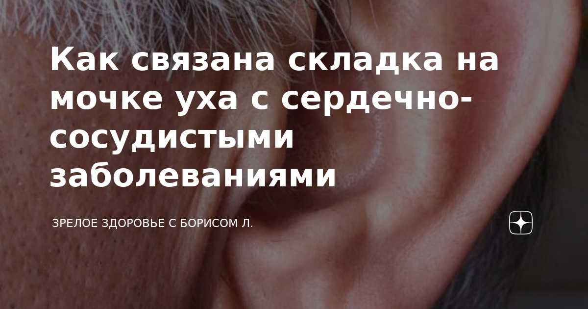 Посмотрите на мочку уха: эта складка подскажет, что ваше сердце и сосуды в опасности — совет врача