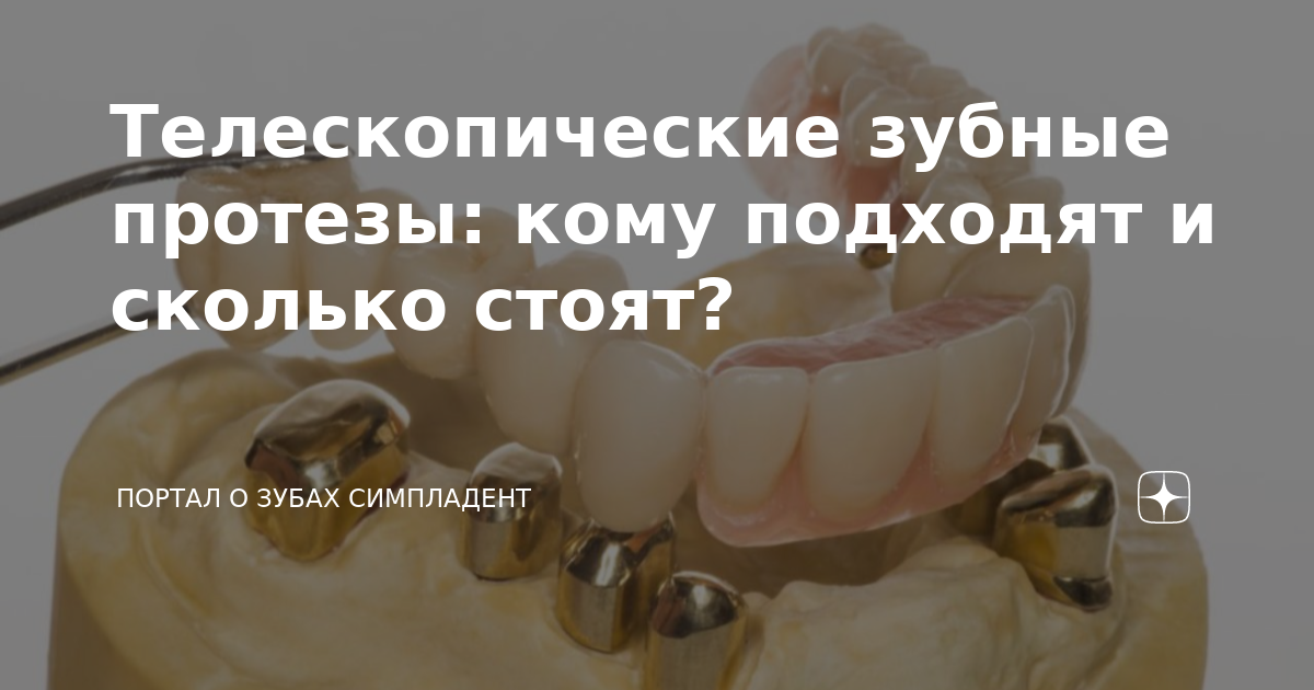 Протез кома. Телескопические протезы зубные. Телескопический протез на верхнюю челюсть. Телескопическая стоматологическая манжета. Покажи телескопические зубы.