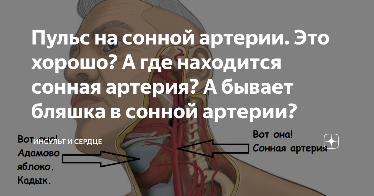 Сонная артерия где находится справа или. Сонная артерия где находится у человека фото с какой стороны.