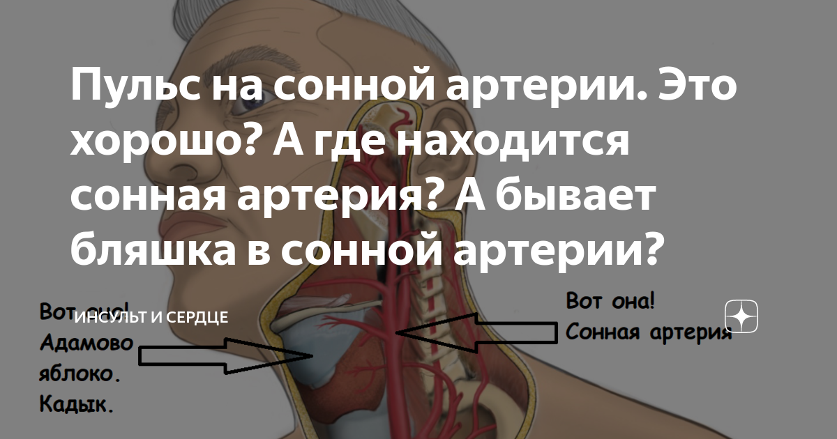 Стеноз сонной артерии, сосудов головного мозга – что это такое и как лечить?