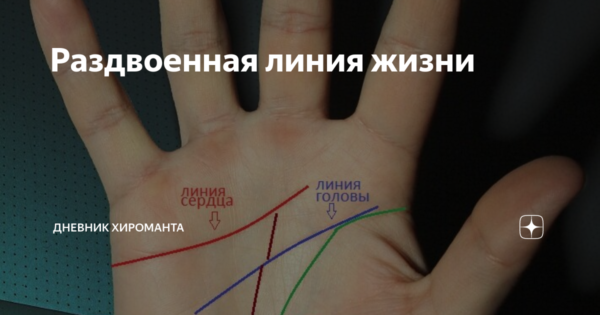 Линия жизни на правой руке: что значат знаки и черточки