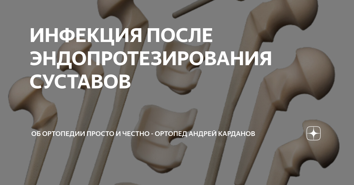 Осложнения после эндопротезирования суставов. Осложнения после эндопротезирования суставов. Эндопротезирование тазобедренного сустава. Противопоказания к эндопротезированию тазобедренного. Тэтс тазобедренного сустава.