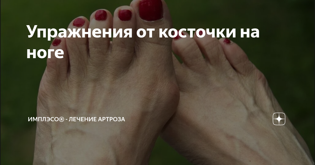 Лечение косточки над пяткой. Косточка на ноге: причины и способы борьбы ВСЕ ПРИЧИНЫ БОЛИ В СТОПЕ. Почему БОЛЯТ НОГИ! Пяточная шпора - причины появления, симптомы заболевания, диагностика и.