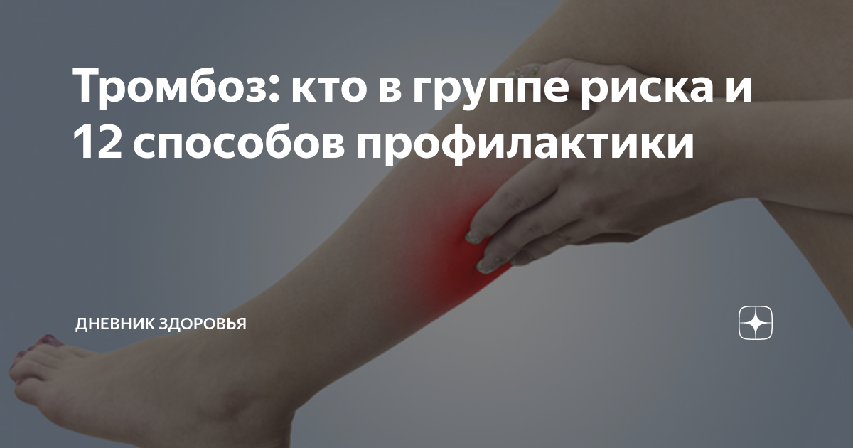 Поведенческие факторы, влияющие на появление тромбоза у сидячих людей
