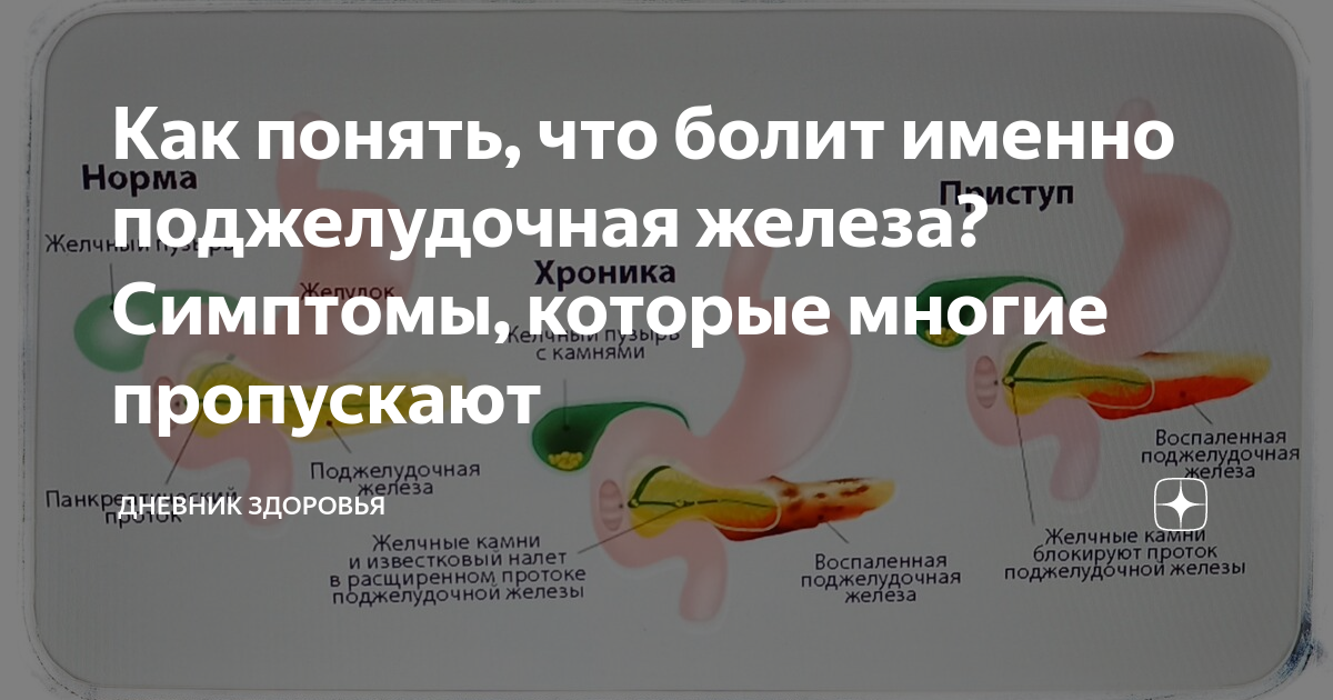 болит желудок от таблеток железа