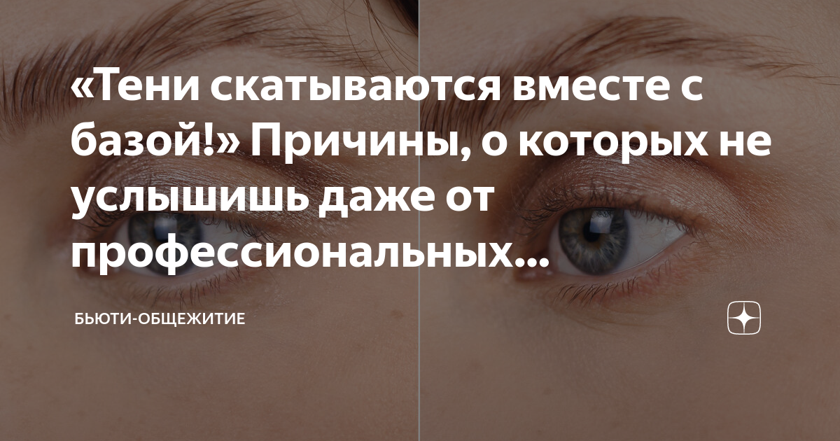 «Тени скатываются вместе с базой!» Причины, о которых не услышишь даже ...