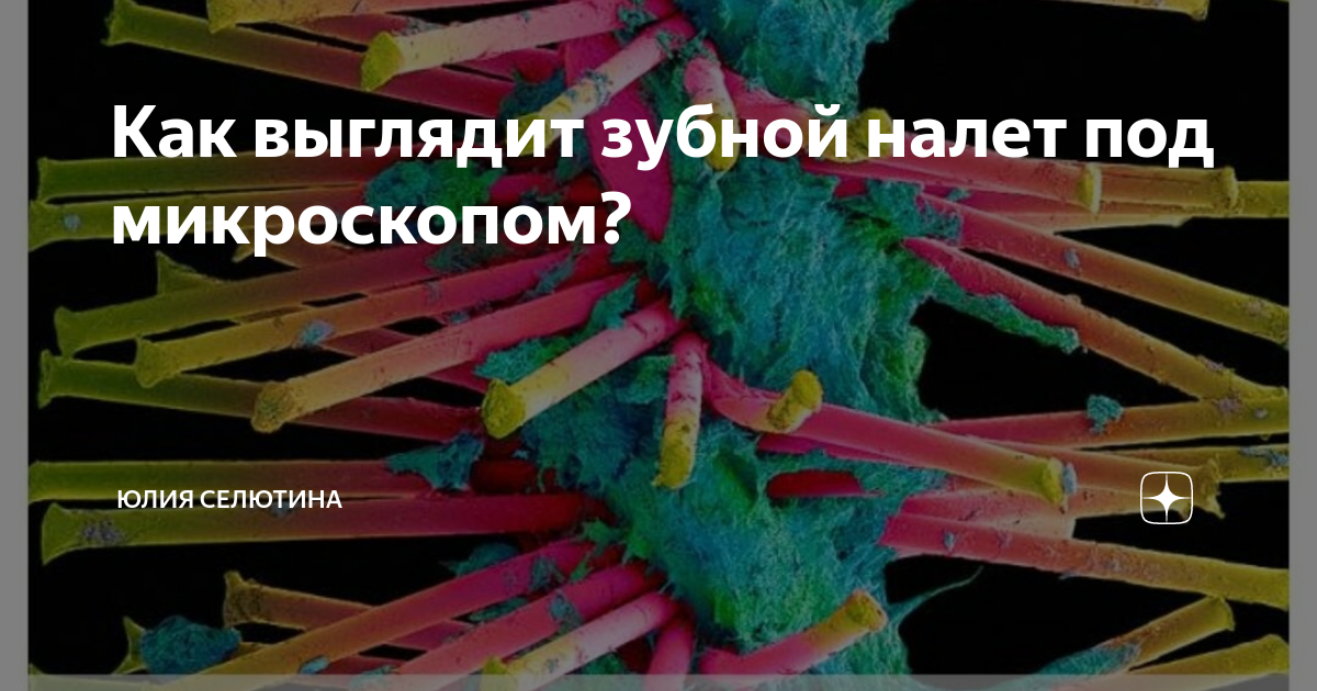 Зубной налет под микроскопом Микроскоп микробы зуба
