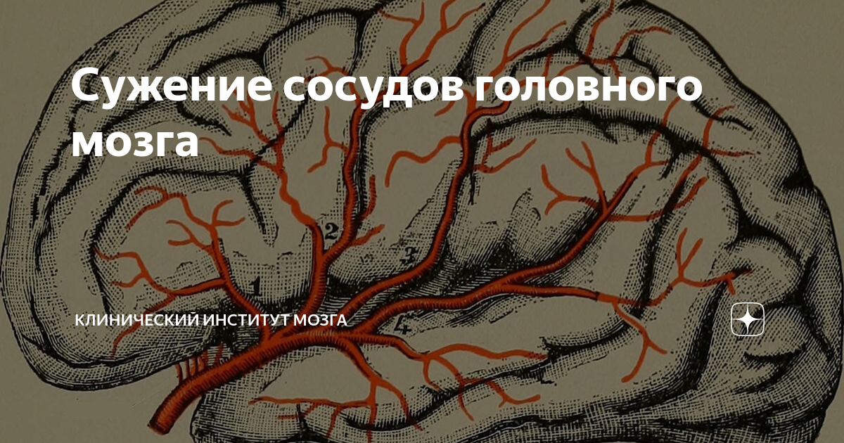 Как проверить сосуды головного мозга