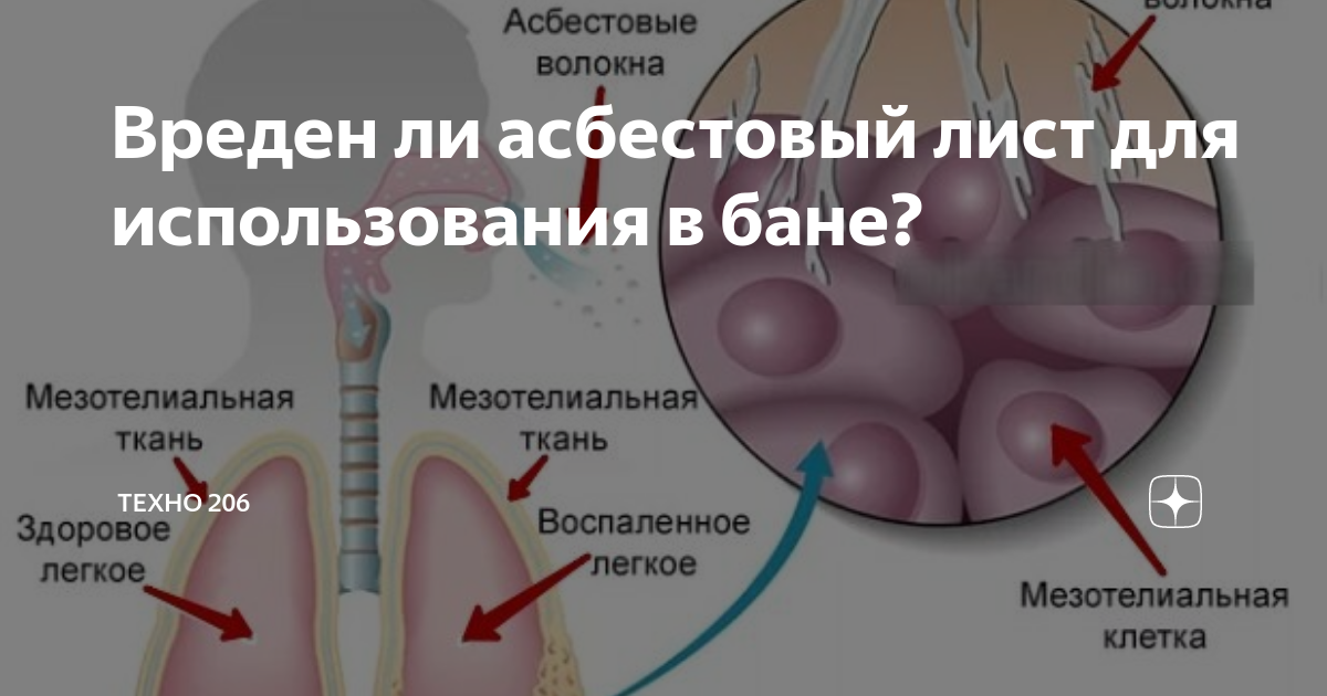 Вреден ли асбестовый лист для использования в бане? | Техно 206 | Дзен