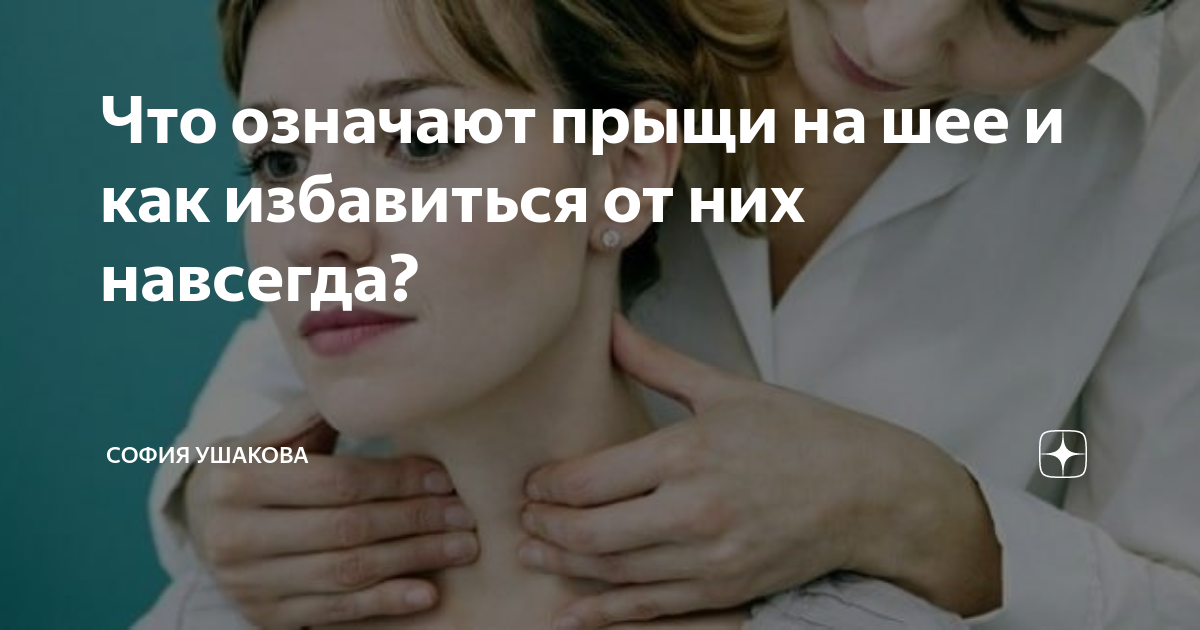 Что означают прыщи на шее и как избавиться от них навсегда? | София Ушакова  | Дзен