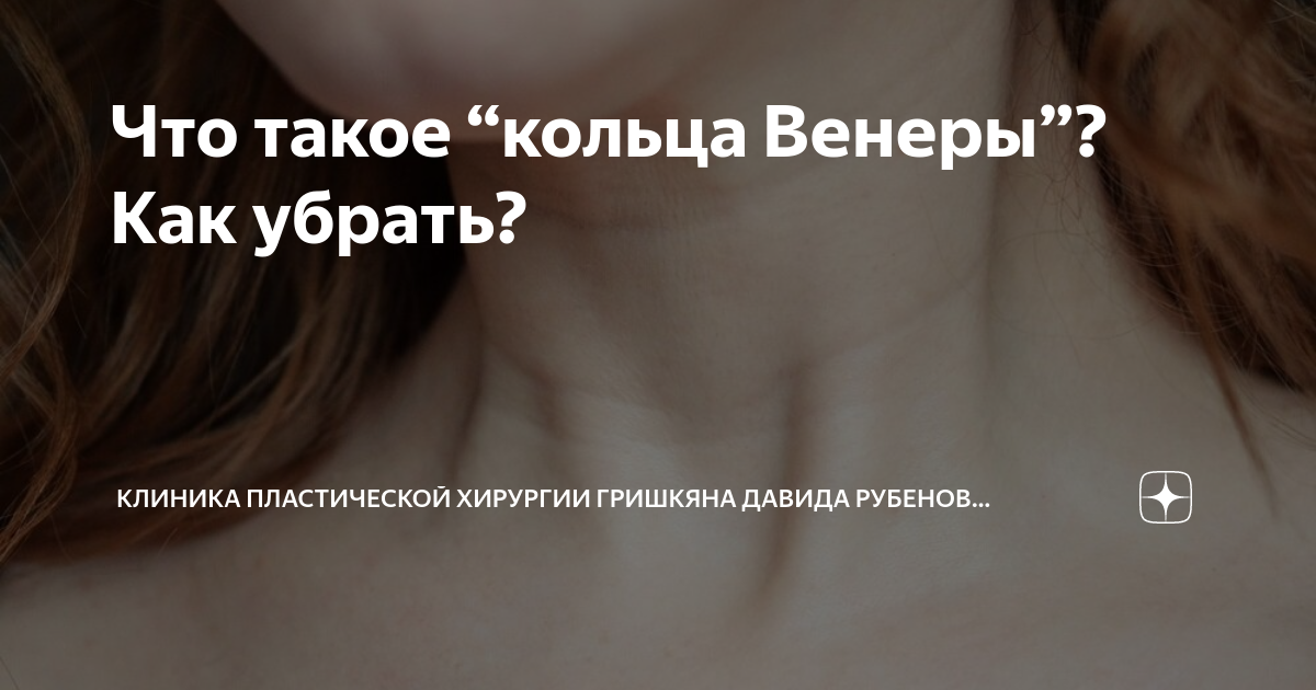 Что такое “кольца Венеры”? Как убрать? | Современный взгляд с Давидом ...