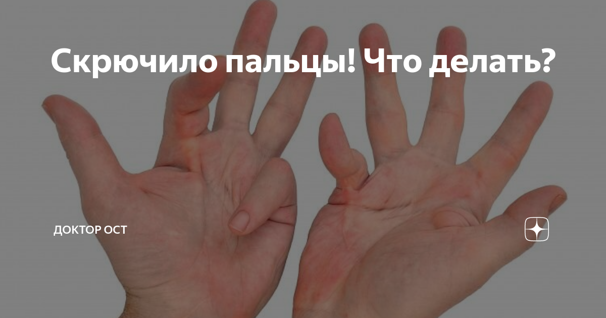 Терпнут пальци при ревматоидном артрите. Ревматоидный артрит суставов: симптомы, диагностика и лечение. Наши. Первые симптомы ревматоидного артрита пальцев рук, лечение Сестринский процесс при ревматоидном артрите, деформирующем.