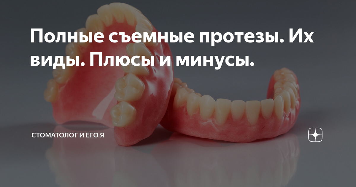 Полные съемные протезы. Их виды. Плюсы и минусы. | Стоматолог и его Я ...