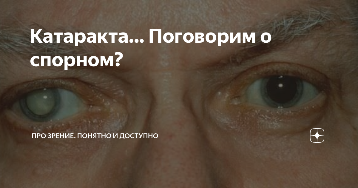 когда восстановится зрение после операции катаракта